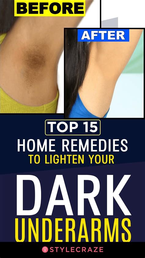 Top 15 Home Remedies To Lighten Your Dark Underarms Dark Underarms Dark Underarms Remedy