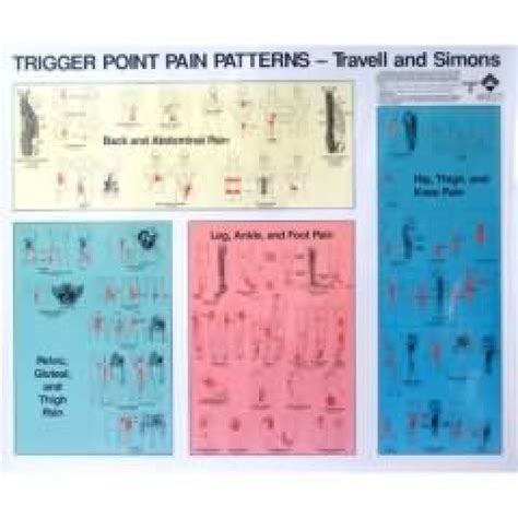 Trigger Point Pain Patterns Chart Poster Set Of 2