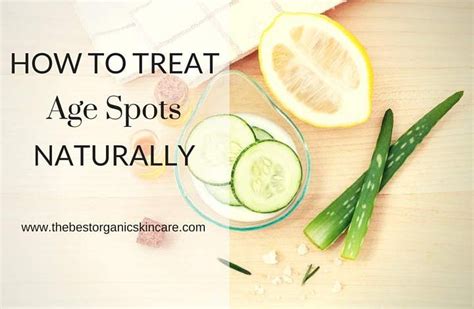 How To Treat Age Spots Naturally Age Spot Remedies Age Spots Skin