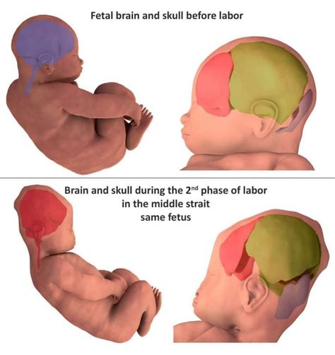 3d Images Reveal How Infants Heads Change Shape During Birth
