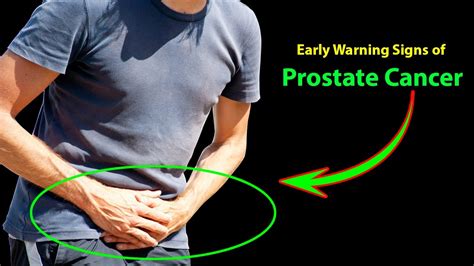 EARLY WARNING SIGNS OF PROSTATE CANCER THAT EVERY GUY NEEDS TO KNOW DO NOT IGNORE YouTube