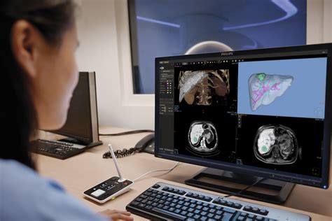 Philips Launches Intellispace Portal 11 At Ecr 2019 News Philips