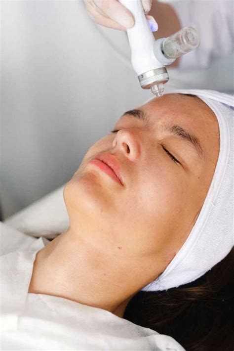 Medical Grade Chemical Skin Peels One Stop Solution For Common Skin