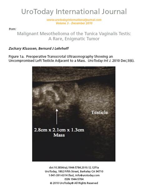 Treatment For Testicular Mesothelioma Malignant Mesothelioma Of The