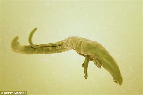 Potentially Deadly Worm Parasite You Can Get While Swimming Or Enjoying