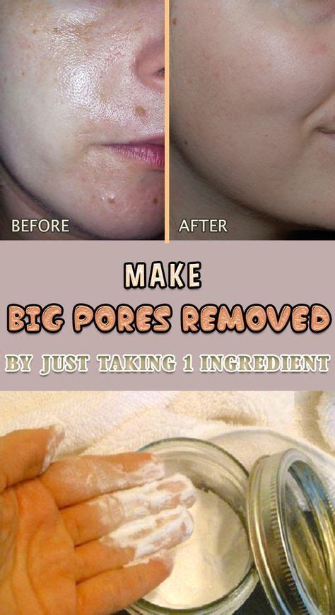 How To Get Rid Of Large Pores Just By Using 1 Ingredient With Images