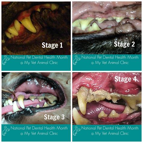 Four Stages Of Periodontal Disease Preventive Care And Regular