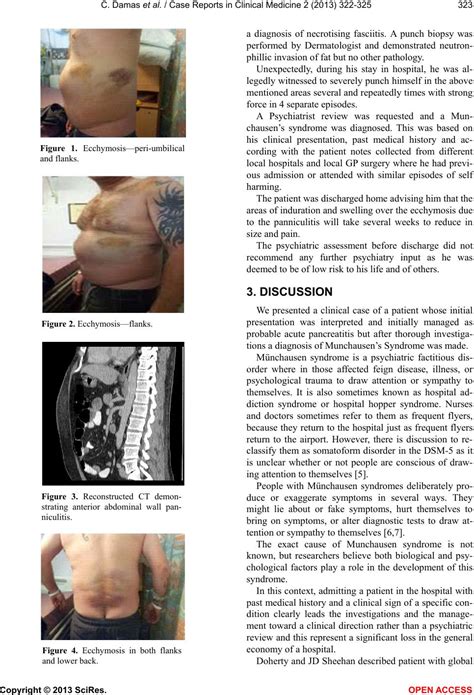 Abdominal Panniculitis As A Presentation Of Munchausen Syndrome