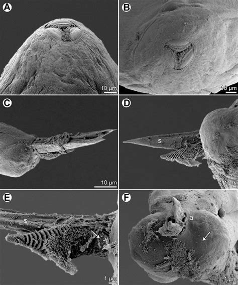 Philometra Protonibeae N Sp From Protonibea Diacanthus Scanning