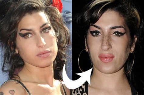 Celebrity Amy Winehouse Before And After Celeb Surgerycom