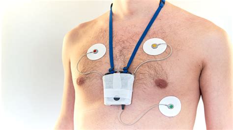 What Is A Holter Monitor Health Choices First