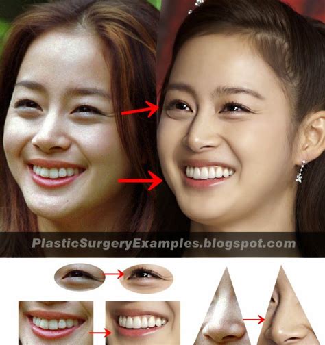 face surgery eyelid surgery bigger eyes kim tae hee double eyelid pretty hair color