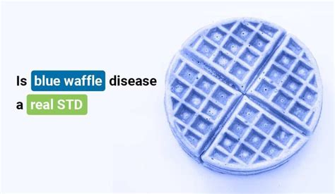 Is Blue Waffle Disease A Real Std
