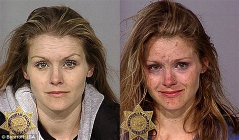 From Drugs To Mugs Shocking Before And After Photos Show Drug Addiction Takes Its Toll Daily