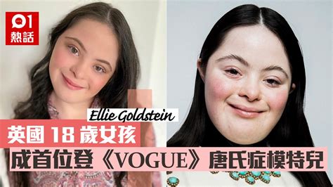 唐氏綜合症女孩夢想「我要做model」 成功登時尚雜誌《vogue》