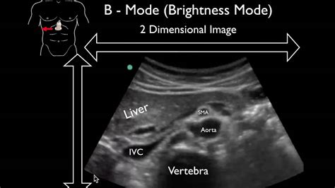 Ultrasound Physics Scanning Modes B Mode Youtube