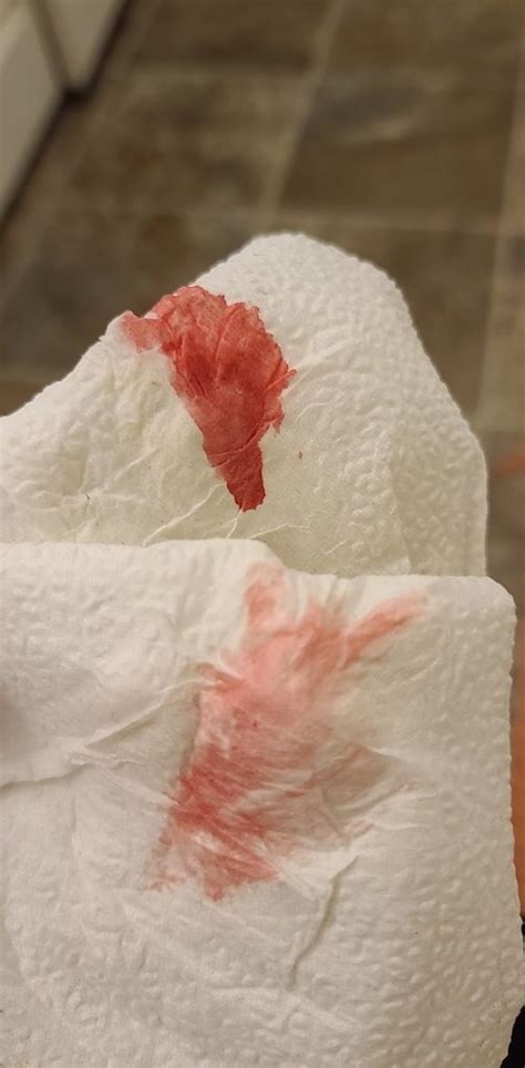 What Does Implantation Bleeding Look Like On Toilet Paper