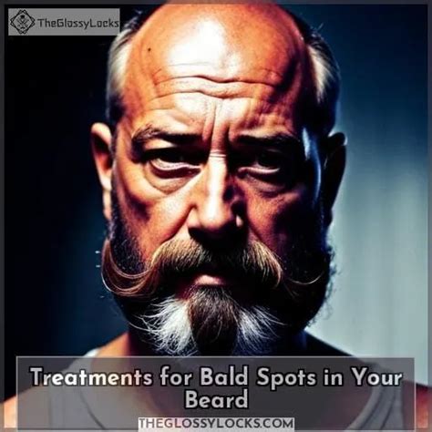 Fix Beard Bald Spots Causes Treatments And Home Remedies