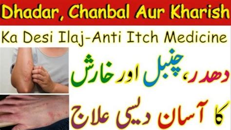 Dhadar Chanbal Aur Kharish Ka Desi Ilaj Anti Itch Medicine