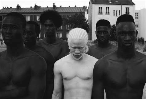 Uganda Nacked Albino Naked Pictures Datawav