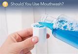 Should You Use Mouthwash After Wisdom Teeth Removal Images