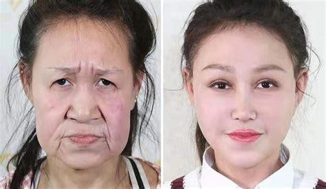 I Have A Face Of A Year Old How One Chinese Teenager Was Given A New Face For Free By