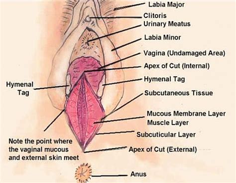 Perineal Tear Perineal Lacerations Types 1st 2nd