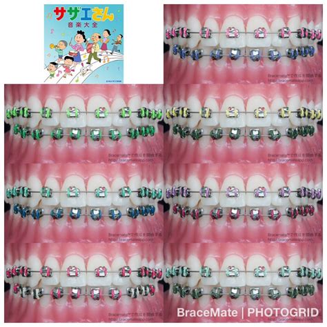 √ Color Palette For Braces