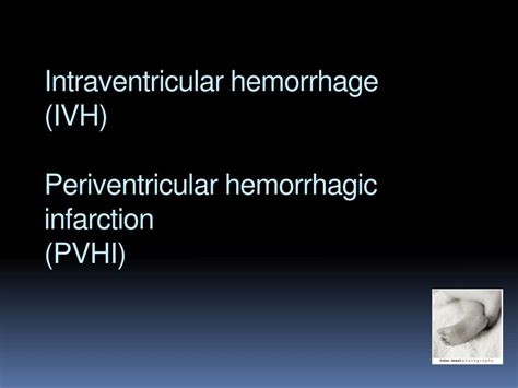 Ppt Common Neonatal Problems Powerpoint Presentation Free Download