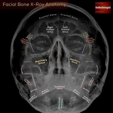 Radiographic Anatomy Of Facial Bones Radiology Medical Radiography My Xxx Hot Girl
