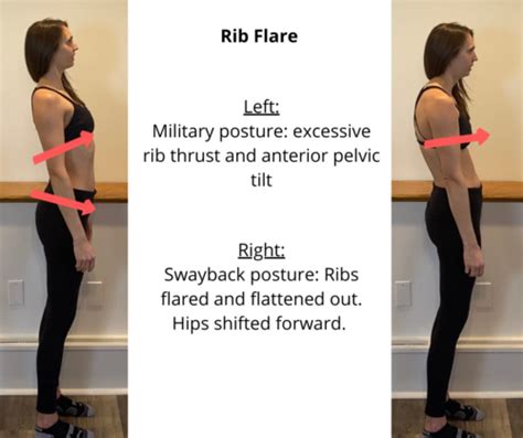 What Is Rib Flare Core Exercise Solutions