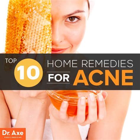 10 Home Remedies For Acne That Work Dr Axe Home Remedies For Acne