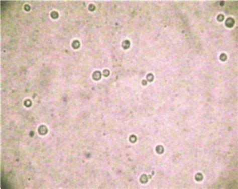 Cryptococcus Neoformans On India Ink Staining Download Scientific