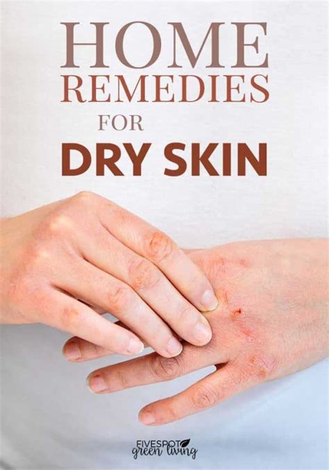 Natural Home Remedies For Dry Skin Five Spot Green Living