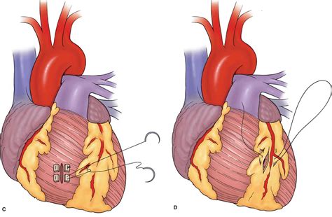 Atlas Of Trauma Trauma 7th Ed