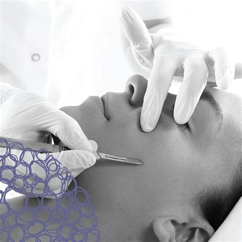 Sharplight™ Laser Treatment — Skin Resurfacing Fractional Laser — Sincerely Skin Spa And