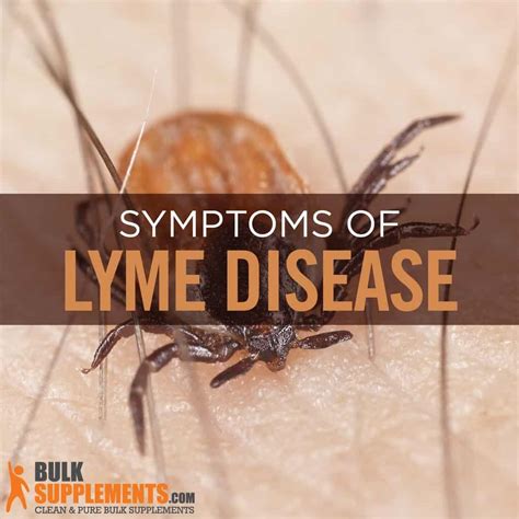 Lyme Disease Symptoms Causes And Treatment