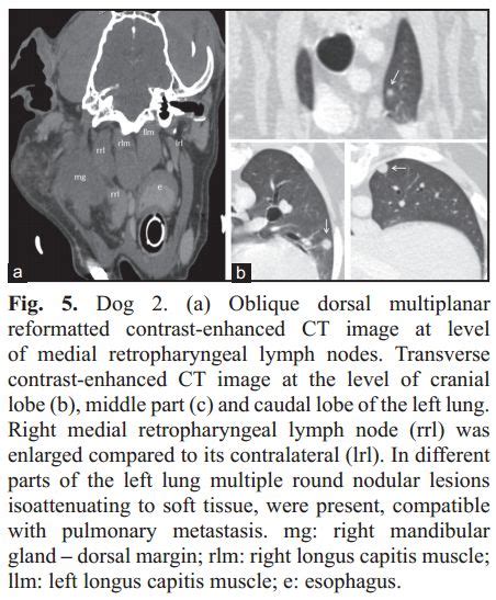 Ultrasound And Multidetector Computed Tomography Of Mandibular Salivary