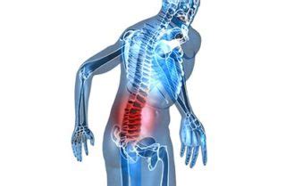 Mechanical Back Pain Shimspine