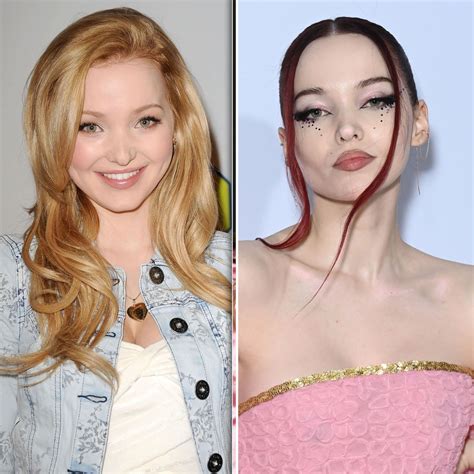 Did Dove Cameron Get Plastic Surgery Then Now Photos