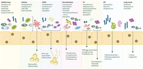 A Clinicians Review Of The Respiratory Microbiome European