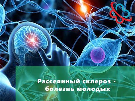 Диета эмбри рассеянный склероз