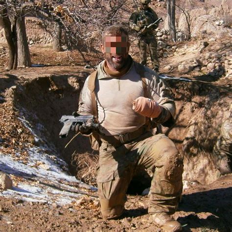An Australian Sas Operator Shows Off His Wounded Hand And Damaged