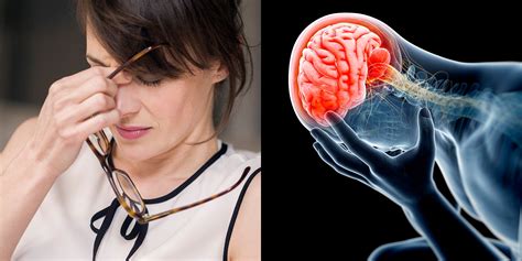 The 7 Most Common Migraine Triggers Self