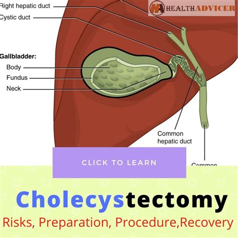 Cholecystectomy Risks Preparation Procedure Cost Recovery