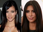 G 99 News: Antes e depois: veja a transformação de Kim Kardashian, a ...