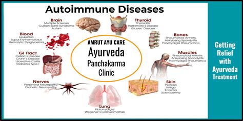 According To Ayurveda Autoimmune Diseases Are Formed Due To Excess