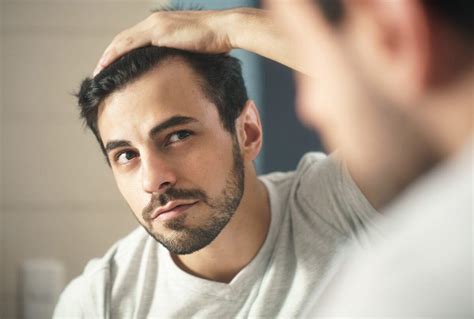 5 Early Signs Of Balding And What You Can Do About It