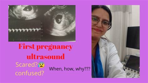 When To Do The First Pregnancy Ultrasound Scan Lets See Youtube