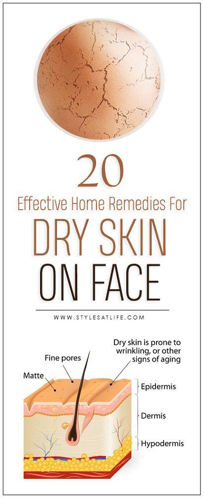 15 Best Home Remedies To Get Rid Of Dry Skin Problems Dry Skin On